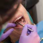 Dental Benefits and Gum Disease: What You Need to Consider