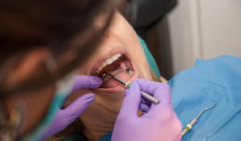 4 Ways Your Dental Insurance Covers Gum Disease Treatment