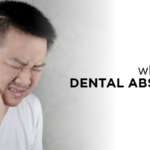 A dental abscess is a pocket of pus that is triggered by a bacterial infection. Learn more about what a dental abscess is, the symptoms of a dental abscess, what causes a dental abscess, prevention methods, and how to treat a dental abscess.